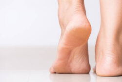 Close‑up of feet on a smooth floor, with visible cracked skin on the heels.