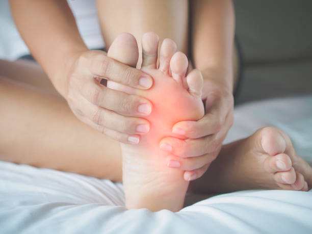 A person sits on a bed holding the sole of one foot, which appears reddened.